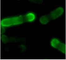 アポトーシスによる細胞死を引き起こした分裂酵母